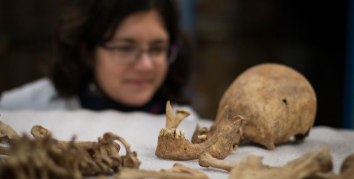 York gladiator skull: An archaeologist examines a York Roman gladiator skull for the camera. January 19, 2016. York Archaeological Trust.; decapitation