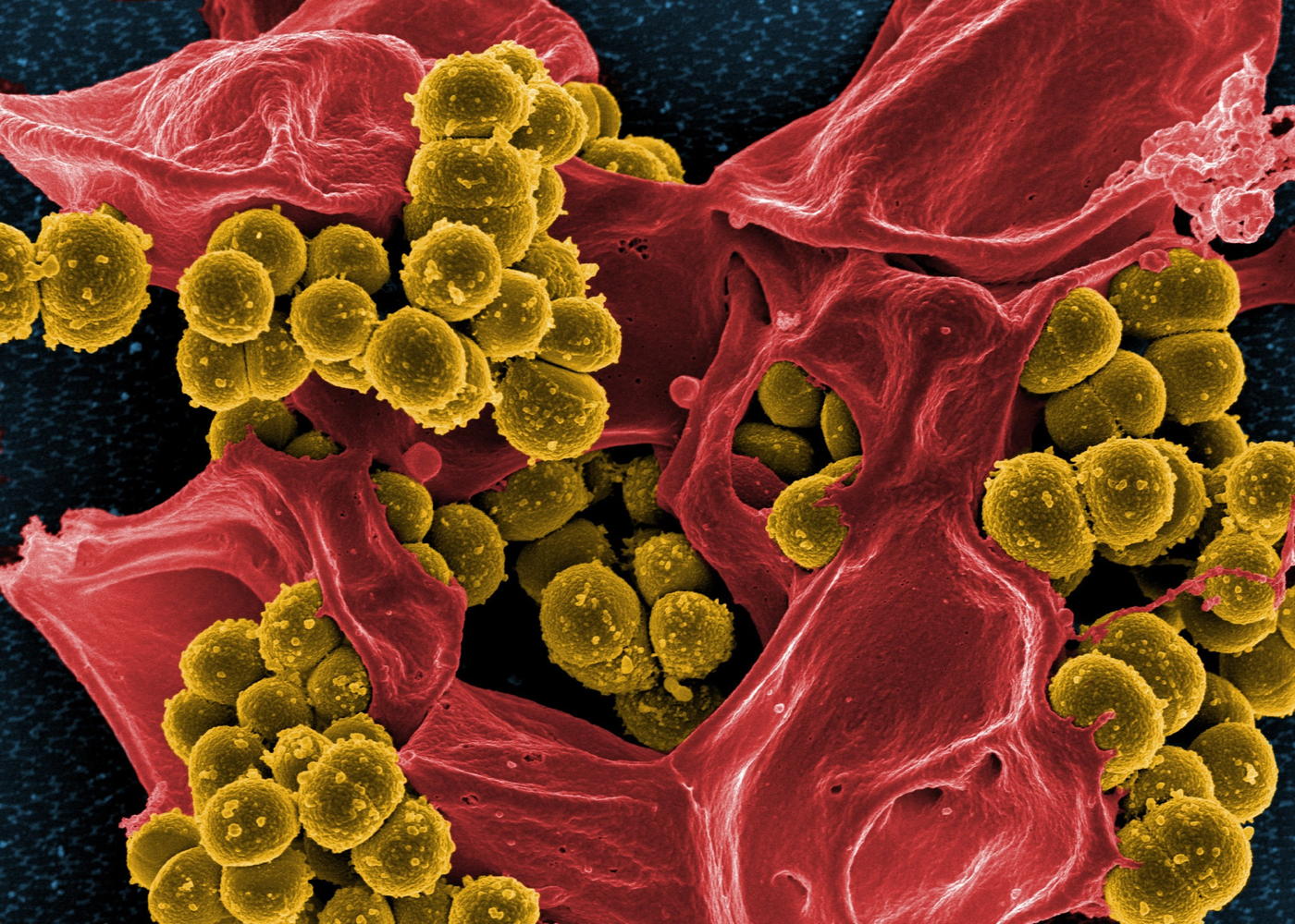 Methicillin-resistant Staph bacteria: “Scanning electron micrograph of methicillin-resistant Staphylococcus aureus bacteria (yellow) and a dead human white blood cell (colored red.)” From the National Institute of Allergy and Infectious Diseases (NIAID)/NIH, June 30, 2006.; antibiotics; bacteria